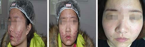 广州肤康皮肤病医院