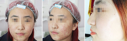 广州肤康皮肤病医院