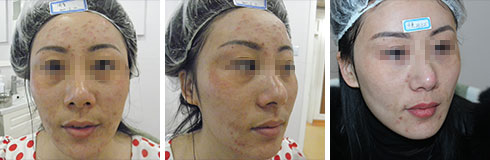 广州肤康皮肤病医院