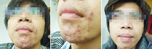 广州肤康皮肤病医院