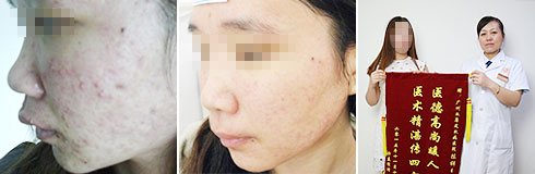 广州肤康皮肤病医院