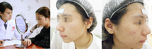 广州肤康皮肤病医院