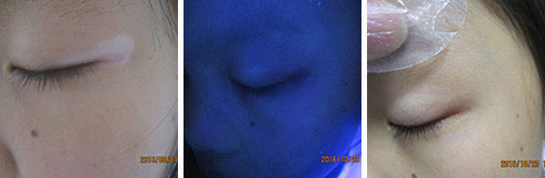 ���ݷ���Ƥ����ҽԺ