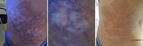 ���ݷ���Ƥ����ҽԺ