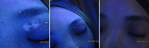 ���ݷ���Ƥ����ҽԺ