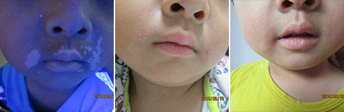 ���ݷ���Ƥ����ҽԺ