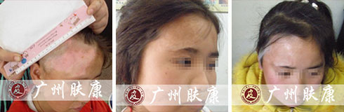 ���ݷ���Ƥ����ҽԺ