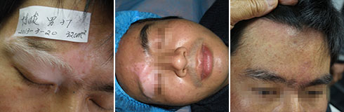 ���ݷ���Ƥ����ҽԺ