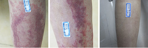 ���ݷ���Ƥ����ҽԺ