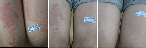 ���ݷ���Ƥ����ҽԺ