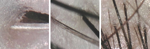 ���ݷ���Ƥ����ҽԺ