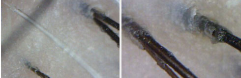 ���ݷ���Ƥ����ҽԺ