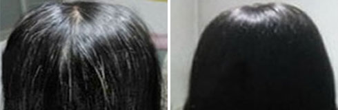 ���ݷ���Ƥ����ҽԺ