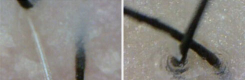 ���ݷ���Ƥ����ҽԺ