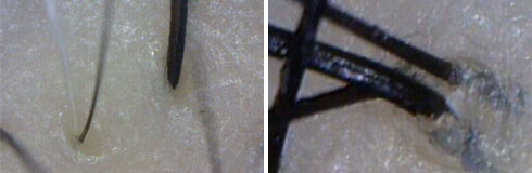 ���ݷ���Ƥ����ҽԺ