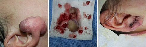 ���ݷ���Ƥ����ҽԺ