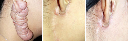 ���ݷ���Ƥ����ҽԺ