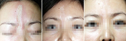 ���ݷ���Ƥ����ҽԺ