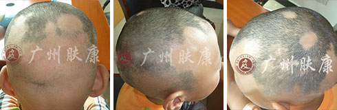 ���ݷ���Ƥ����ҽԺ