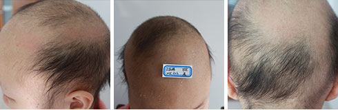 ���ݷ���Ƥ����ҽԺ