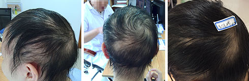 ���ݷ���Ƥ����ҽԺ