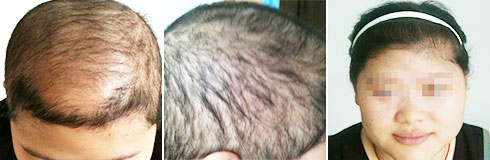 ���ݷ���Ƥ����ҽԺ