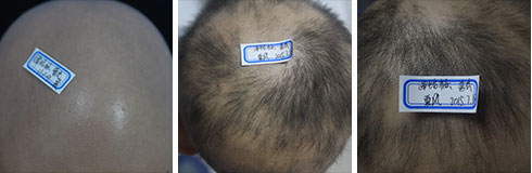 ���ݷ���Ƥ����ҽԺ