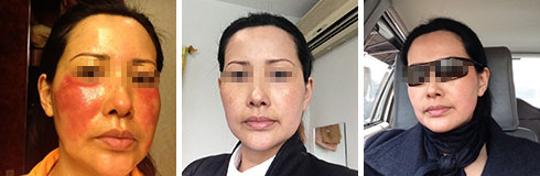 ���ݷ���Ƥ����ҽԺ