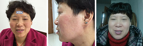 ���ݷ���Ƥ����ҽԺ