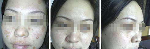 ���ݷ���Ƥ����ҽԺ