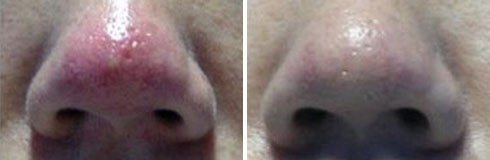 ���ݷ���Ƥ����ҽԺ