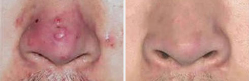 ���ݷ���Ƥ����ҽԺ