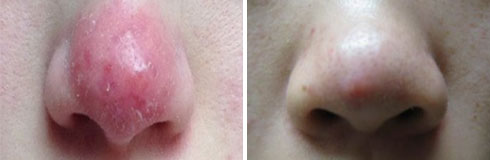 ���ݷ���Ƥ����ҽԺ