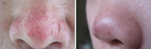 ���ݷ���Ƥ����ҽԺ