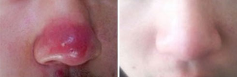 ���ݷ���Ƥ����ҽԺ