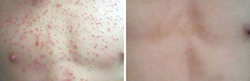 ���ݷ���Ƥ����ҽԺ