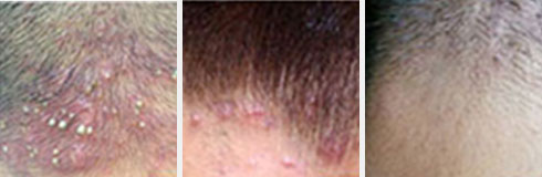 ���ݷ���Ƥ����ҽԺ