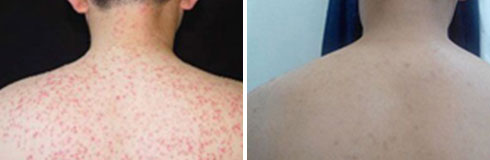 ���ݷ���Ƥ����ҽԺ