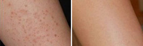 ���ݷ���Ƥ����ҽԺ