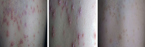 ���ݷ���Ƥ����ҽԺ