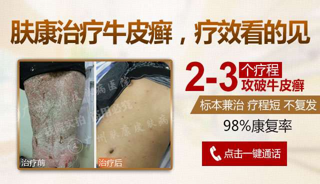 ���ݷ���Ƥ����ҽԺ