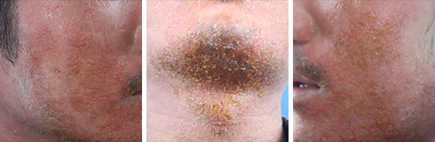 ���ݷ���Ƥ����ҽԺ