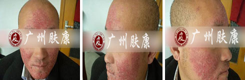 ���ݷ���Ƥ����ҽԺ