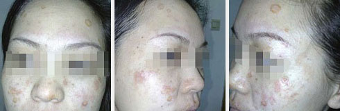 ���ݷ���Ƥ����ҽԺ