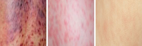 ���ݷ���Ƥ����ҽԺ