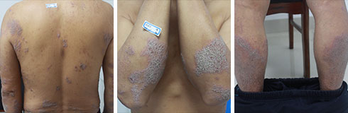 ���ݷ���Ƥ����ҽԺ