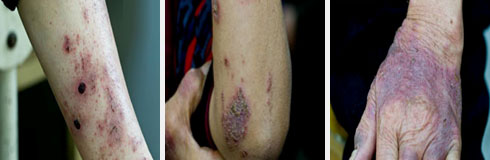 ���ݷ���Ƥ����ҽԺ