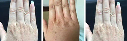 ���ݷ���Ƥ����ҽԺ