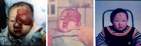 ���ݷ���Ƥ����ҽԺ