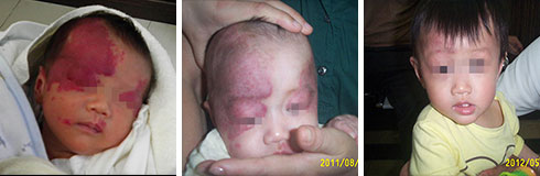 ���ݷ���Ƥ����ҽԺ